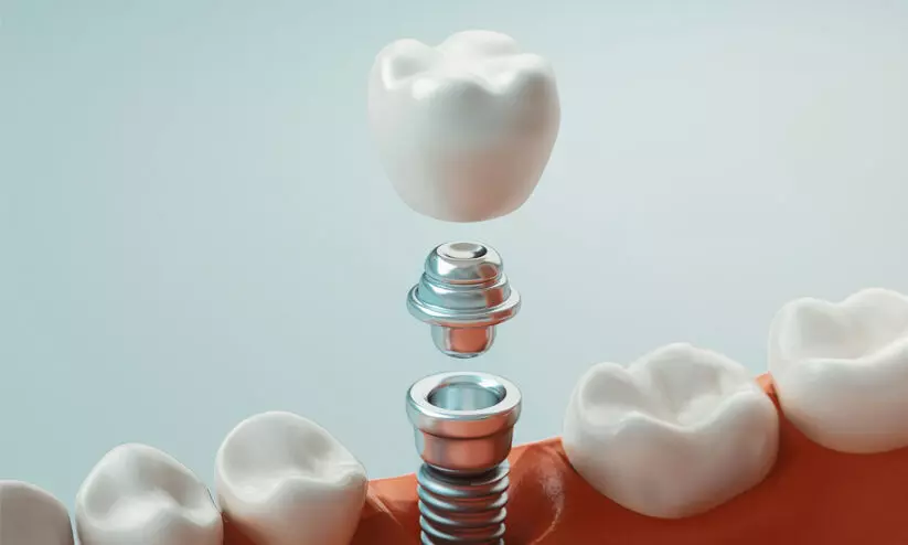 artificial teeth