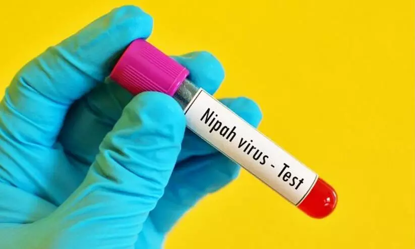 nipah virus