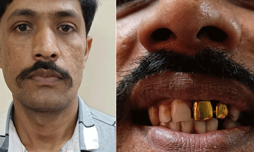 Two gold teeth help cops nab man on the run for 15 years