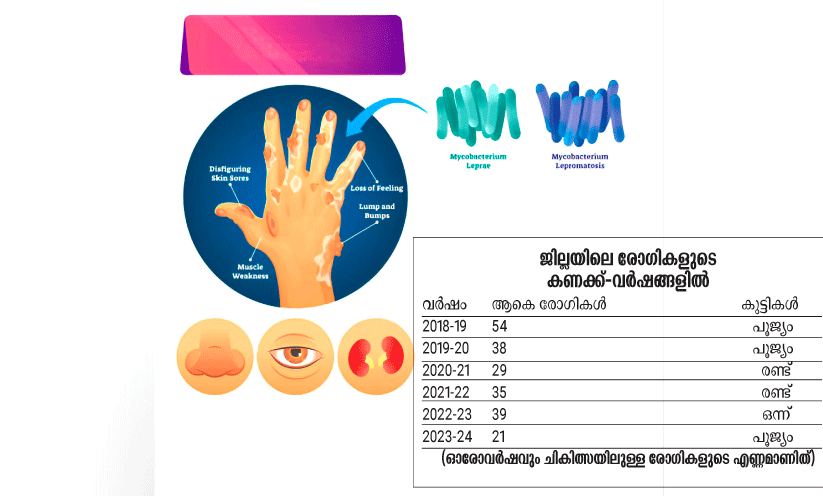 കുഷ്ഠരോഗം നാട്ടിലിപ്പോഴുമുണ്ട് വേണം, കരുതൽ