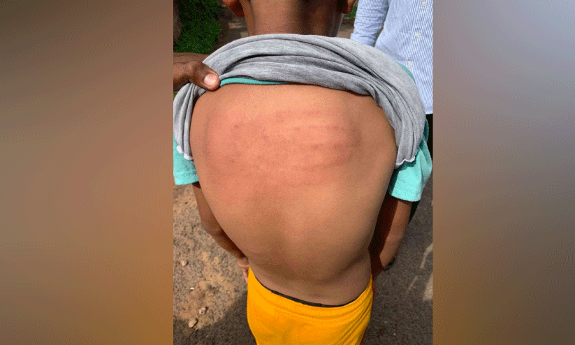 injuries of  10-year-old boy