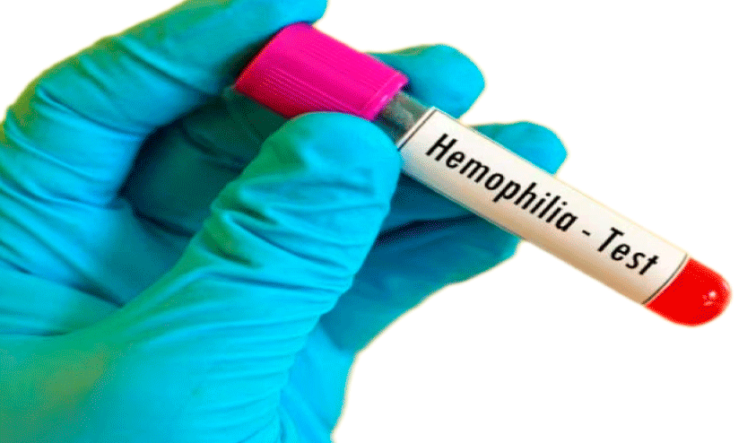 Hemophilia