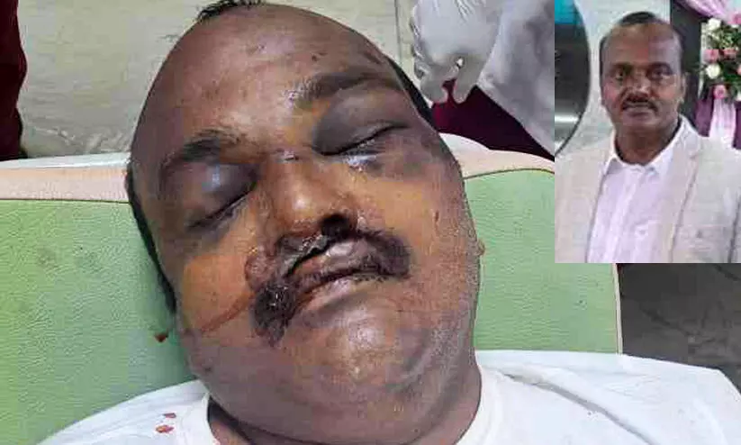 Kaipamangalam Arun Murder