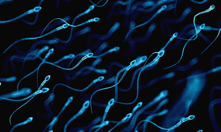 sperm